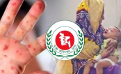হাম ও উপসর্গ নিয়ে আরও ৫ শিশুর মৃত্যু হাম ও উপসর্গ নিয়ে আরও ৫ শিশুর মৃত্যু